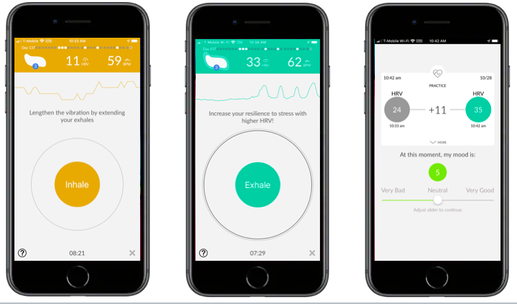 Heart rate variability